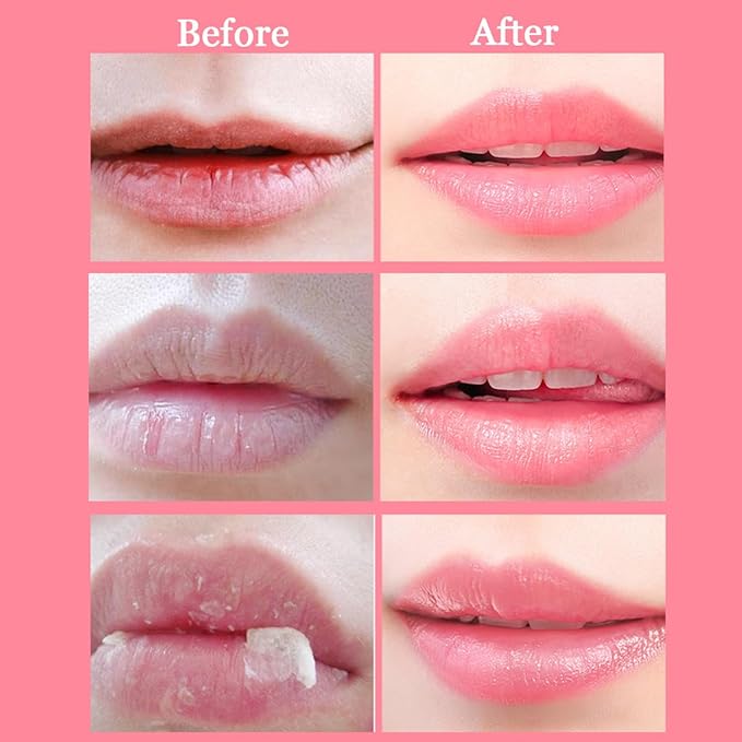 2 Pcs Bee Lip Balm Honey Pot,Honey & Strawberry Lip Mask Propolis Moisturizing Lip Balm with Stick,Prevention Dry and Cracked Lip Scrubs,Exfoliator Lip Wrinkle Skin Care Products-GlimoraGlow