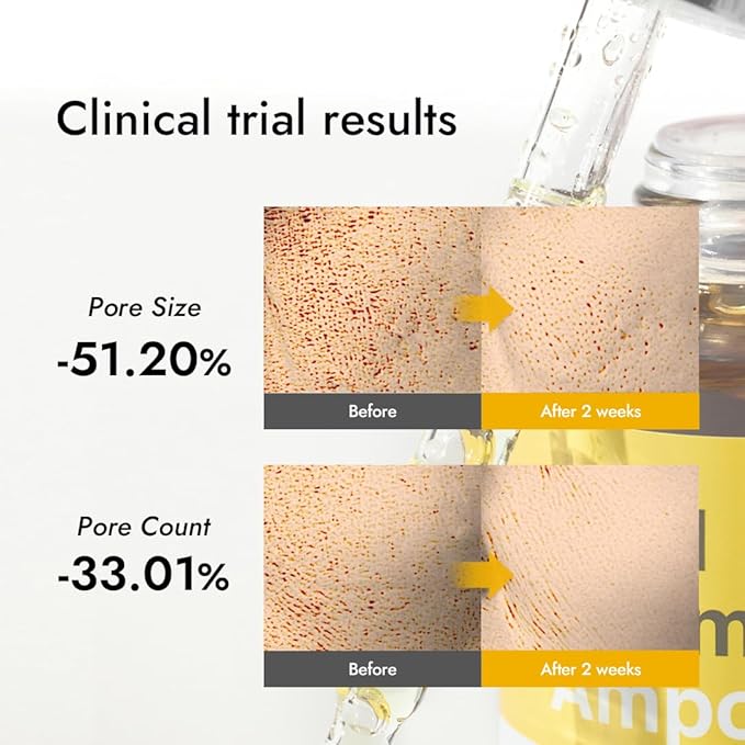 MIZON Real Vitamin C Ampoule, Pure Vitamin C, No Water Added,10 Ingredients, Nutrition, Face Moisturizer (1.01 fl oz)-GlimoraGlow