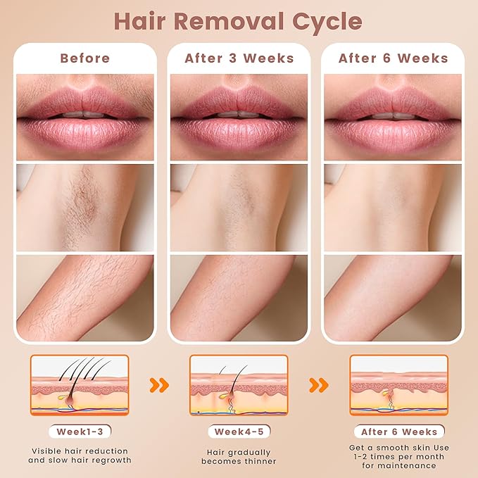 IPL Hair Removal Device, Hair Removal for Women and Men at home for Armpits Legs Arms Bikini Line,model S3-GlimoraGlow