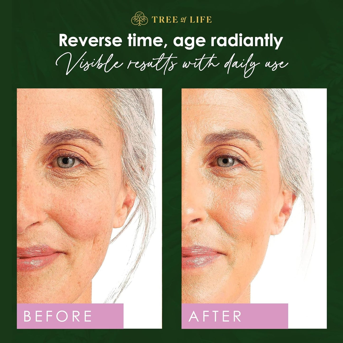 Tree of Life Beauty Retinol Serum, Skin Smoothing Face Oil for Dark and Age Spots and Fine Lines, Facial Serums for Dry and Sensitive Skin Care with Hyaluronic Acid for Soft Smooth Skin, 2 Fl Oz-GlimoraGlow