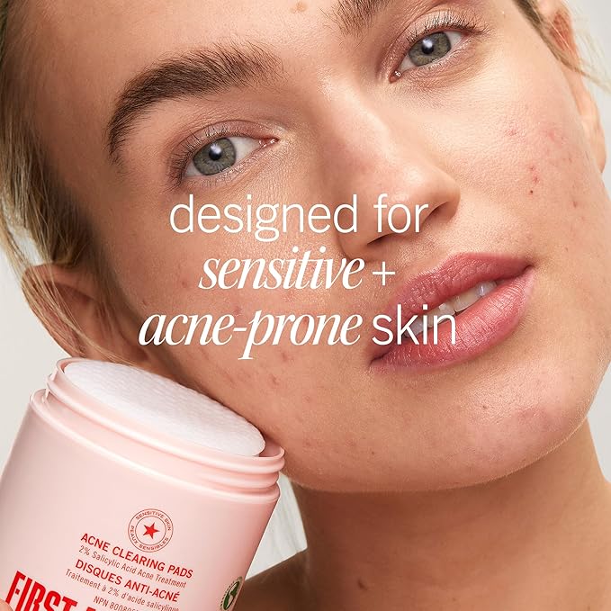 First Aid Beauty Acne Pads for Face - Maximum Strength Acne Treatment - 2% Salicylic Acid Pads Treat Without Drying, (60-ct)-GlimoraGlow