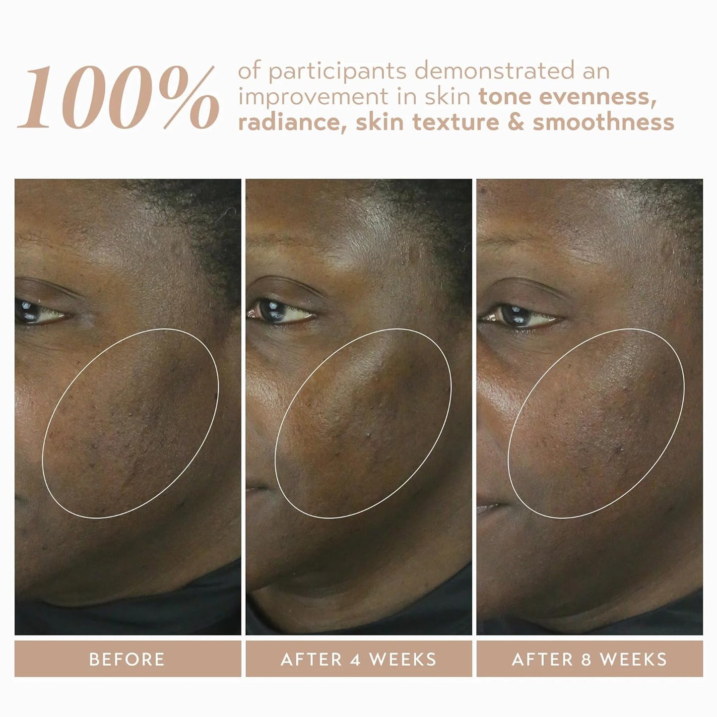 SHANI DARDEN SKIN CARE Retinol Reform with 1% Encapsulated Retinol Serum for Face & Neck, Gentle Slow-Release Face Serum with Tripeptide for Wrinkles, Fine Lines & Uneven Tone, 1 fl oz-GlimoraGlow