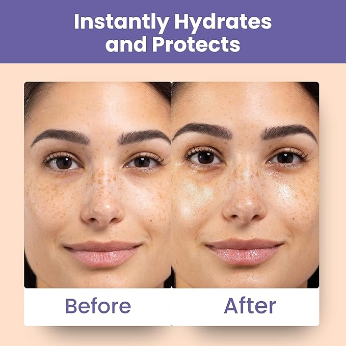 Patchology Skin Remedy Calm & Protect Micro Mist – Hydrating Facial Spray with Ectoin, Probiotics & Botanical Blend - Fragrance Free - Refines Pores & Leaves a Fresh Glow - 80 mL-GlimoraGlow