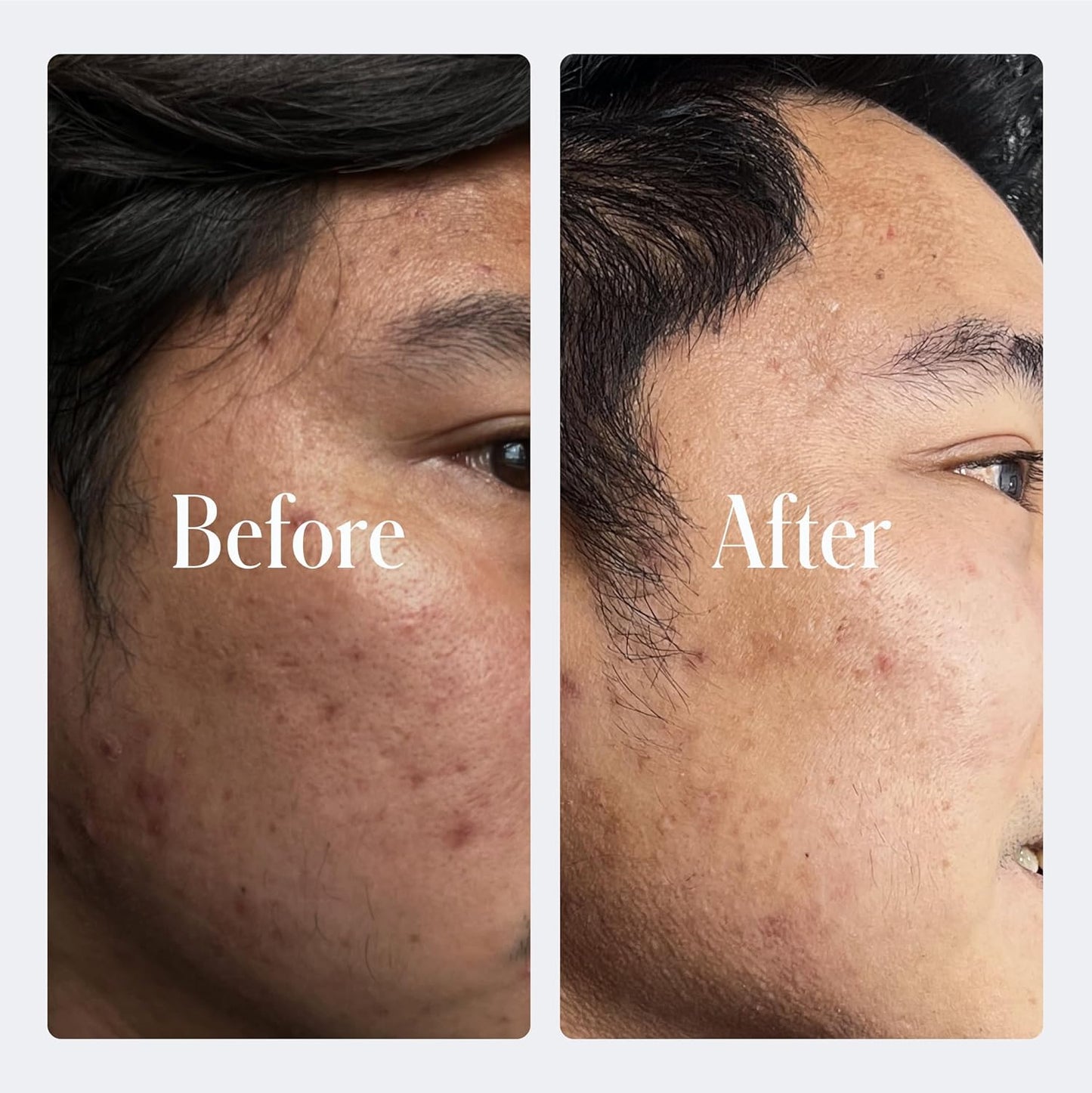 Geologie Retinol Anti-Aging Face Cream | Advanced .3% Retinol Formula for Effective Results | Reduce Fine Lines & Wrinkles | Protect & Repair Skin With Hyaluronic Acid & Niacinamide | For Men & Women-GlimoraGlow