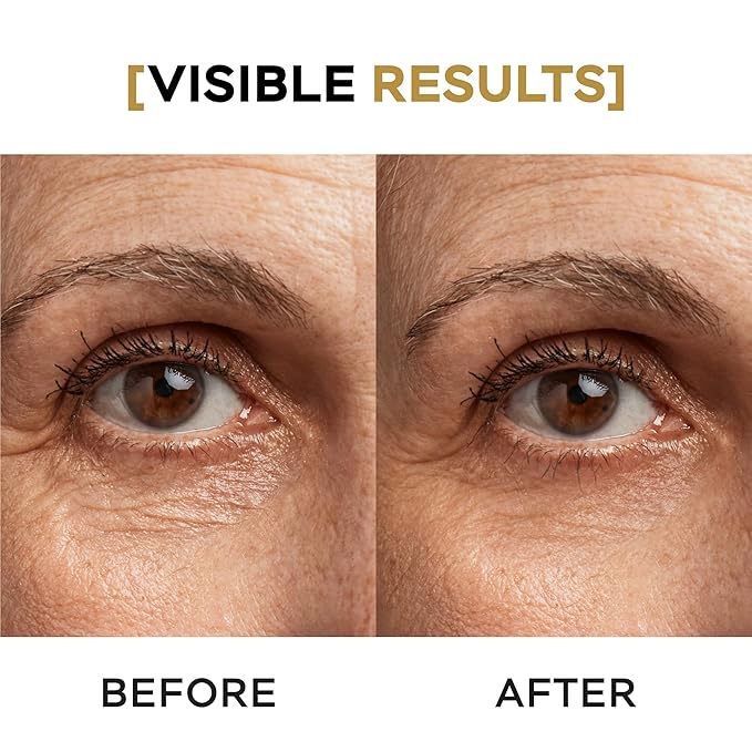 Moisturizing Eye Cream w/Aloe Vera, Collagen, Hyaluronic Acid, Cotton Stem Cells for Dark Circles, Puffiness & Bags - Under Eye Hydration Cream for Women & Men (1 Fl Oz)-GlimoraGlow