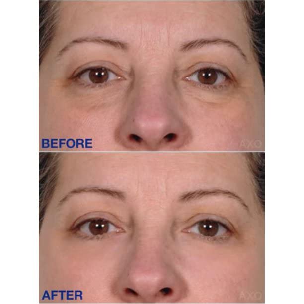 Age-Defying Under-Eye Serum | Best Instant Wrinkle Remover | Advanced Formula Anti Aging Visibly Reduces Under Eye Wrinkles, Bags, Dark Circles, Fine Lines & Crow’s Feet | 100% All-Natural-GlimoraGlow