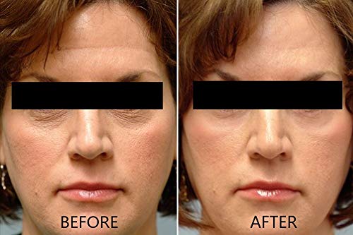 Vitamin C Serum 20% Pure L-Ascorbic Acid, Ferulic Acid, Vitamin E and HA and Hyaluronic Acid Serum with Vitamin B5 for Face and Eyes Natural Anti Aging Anti Wrinkle Set of 2 by Dr. Brenner-GlimoraGlow