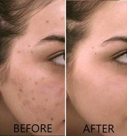 Vitamin C Serum 20% Pure L-Ascorbic Acid, Ferulic Acid, Vitamin E and HA and Hyaluronic Acid Serum with Vitamin B5 for Face and Eyes Natural Anti Aging Anti Wrinkle Set of 2 by Dr. Brenner-GlimoraGlow