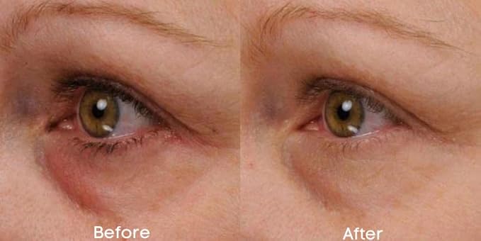 Renew & Firm Eye Serum-GlimoraGlow