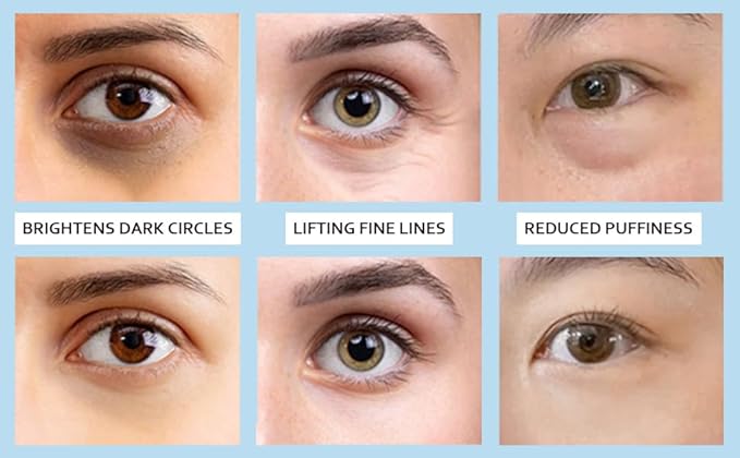 5% Caffeine Eye Serum, Under Eye Roller Cream for Dark Circles and Puffiness with 360°Massage Ball Reduce Wrinkles and Fine Lines，Bags Under Eyes，15ML-GlimoraGlow