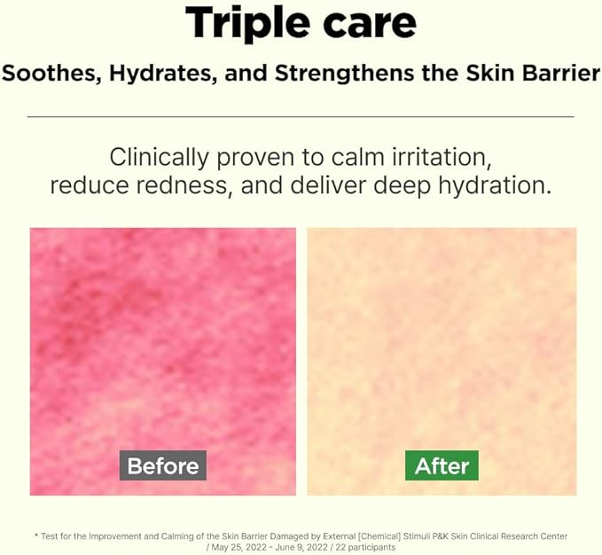 ISOI Moisture Dr. Soothing Toner, Lightweight Hydrating Toner with Tea Tree Ceramide & Hyaluronic Acid for Skin Barrier Support, Korean Skin Care (4.39 fl.oz/130ml)-GlimoraGlow