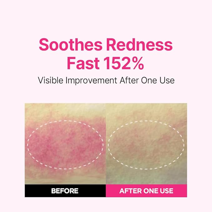 ISOI Blemish Care Up Serum for Face, Vegan Hydrating Serum for Smooth & Glass Skin Effect, Skin Barrier & Moisture Balance for Women, Korean Skin Care (0.85 fl. oz, 25ml)-GlimoraGlow