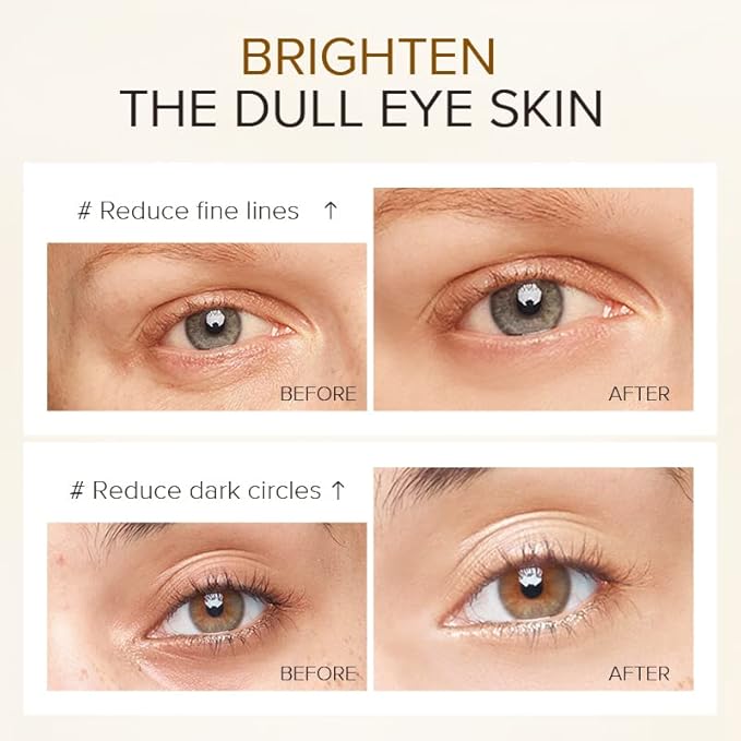 AKARY 24K Gold Eye Serum, Under-eye Firming Serum for Reduces Puffy Eyes, Dark Circles, Fine Lines, Under Eye Bags, Tightening, Hydrating Face Serum, Treatment for Skin Care with Nicotinamide and Vitamin E-GlimoraGlow