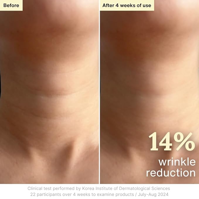 Rothea Resilience Cream, Anti-Aging with Bakuchiol 10,000ppm (Natural Retinol Alternative), Face Moisturizer, Neck Cream with Collagen, Ceramides, Peptides, Niacinamide, Korean Skin Care, 1.7 oz-GlimoraGlow