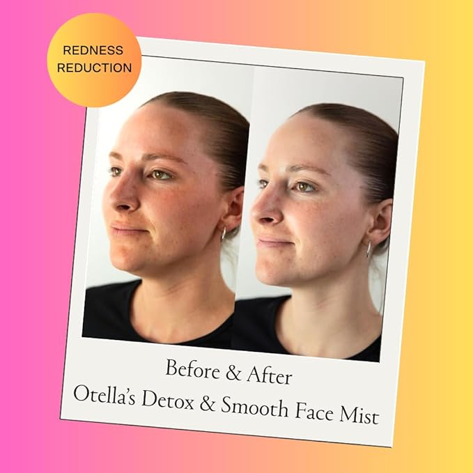 Detox & Soothe Face Mist with Hypochlorous Acid | Reduces Redness & Breakouts | pH Balance & Skin Cleansing for Active Lifestyles | TSA Approved, 2.7 oz | Clean Ingredients-GlimoraGlow