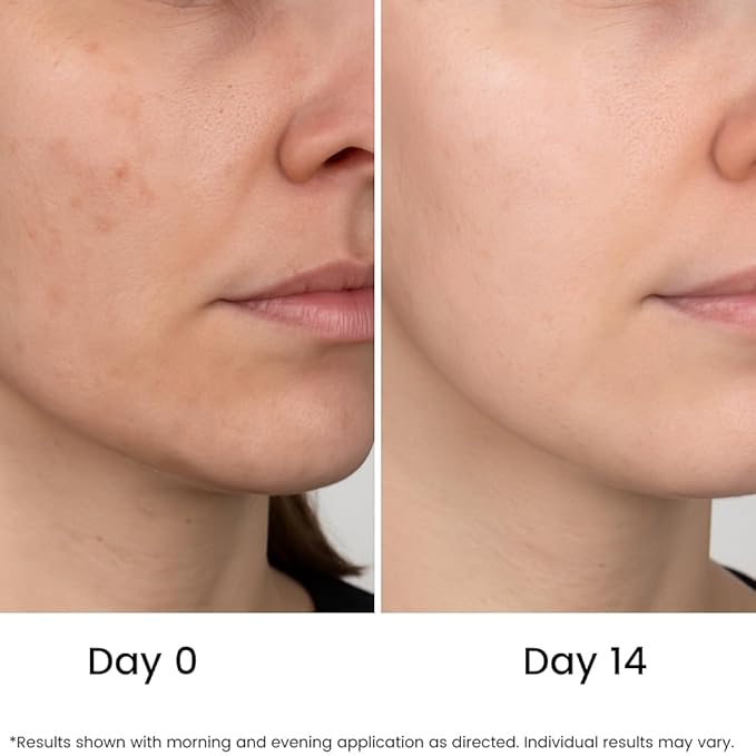 All Natural 20% Vitamin C Serum + 6 Active Boosters for Face, Dark Spots, Wrinkles, Brightening, Hydrating, Even Tone, Healthy Glow with Niacinamide, Hyaluronic Acid, Ferulic Acid, Vitamin E, Peptides-GlimoraGlow