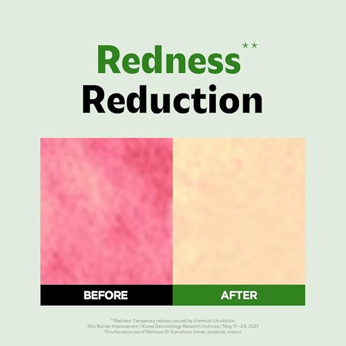 ISOI Moisture Dr. Soothing Cream, Deep Hydration & Barrier Support with Hyaluronic Acid, Lightweight Moisturizer for Sensitive Types, Korean Skin Care (2.37 fl.oz, 70ml)-GlimoraGlow