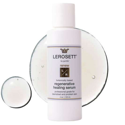 LEROSETT Serum for Acne Scarring Healing, Pimples, Redness, Breakouts, Blemishes, Hydrate & Soothes Irritated Skin, Natural Serum. Spa-Grade, Plant Based, Concentrated - 4 oz-GlimoraGlow
