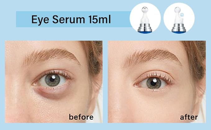 5% Caffeine Eye Serum, Under Eye Roller Cream for Dark Circles and Puffiness with 360°Massage Ball Reduce Wrinkles and Fine Lines，Bags Under Eyes，15ML-GlimoraGlow