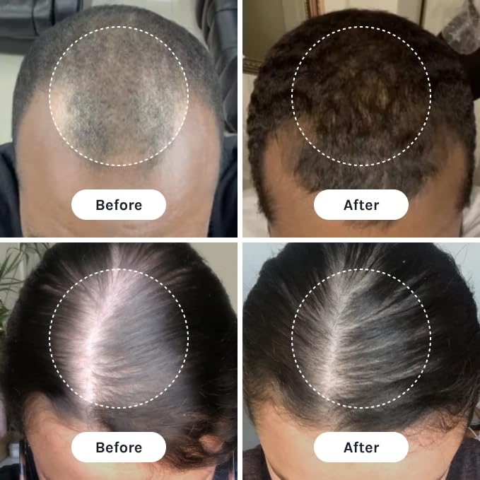 InfiniWell PTD-DBM Peptide Hair Serum for Fuller-Looking Hair - Scalp Treatment for Visible Growth & Follicle Renewal - Reinforce Restoration, Strand Integrity & Optimal Density (25 ml)-GlimoraGlow