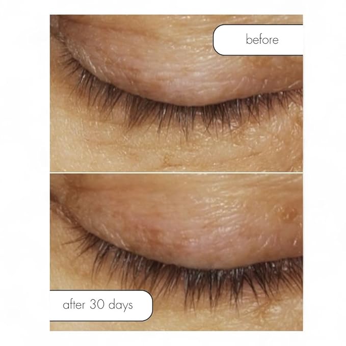 Serious Skincare Lash Bath & Conditioner - Double Action Eye Makeup Remover - Oil Free - Enhancing Peptides Promotes Eyelash Growth - Clover Flower - Effortlessly Removes Waterproof Mascara - 4 oz.-GlimoraGlow