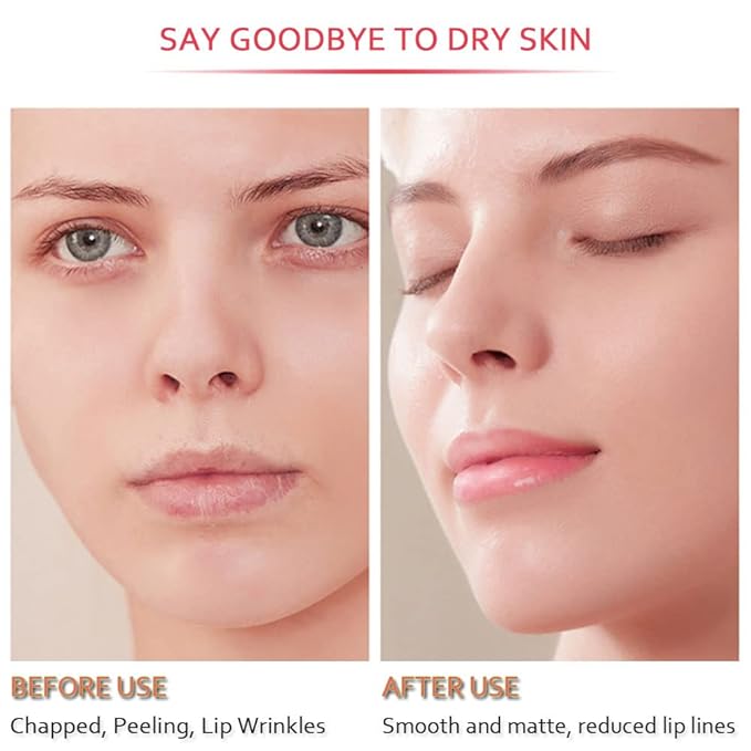 20Pcs Moisturizing Restores Moisture Lip Mask for Dry Lips and Lip Lines Overnight Lip Care, Gel Treatment Plumping Lips Mask (Red)-GlimoraGlow