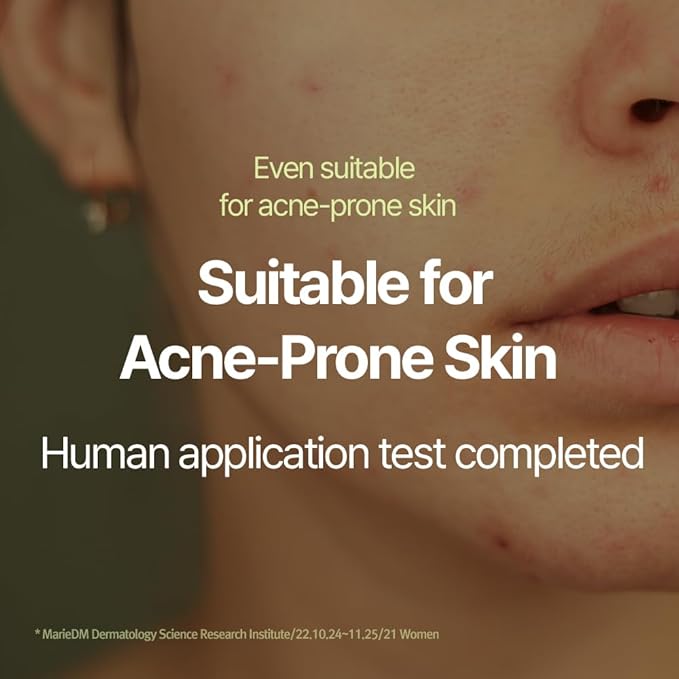 Pyunkang Yul Calming Moisture Serum for Strong Daily Moisturizing Power, Skin Revival & Soothing Care with Centella Asiatica, Tea Tree, 5 Hyaluronic Acids, Ceramide |-GlimoraGlow