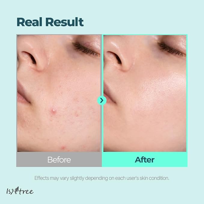 IsNtree Gim PDRN Deep Sleep Mask 80ml, 2.7 fl oz | Korean SEAWEED Skincare Sleeping Mask gel | Night Cream | Facial Mask | Overnight Gel mask for Hydration & Skin Bounce-GlimoraGlow