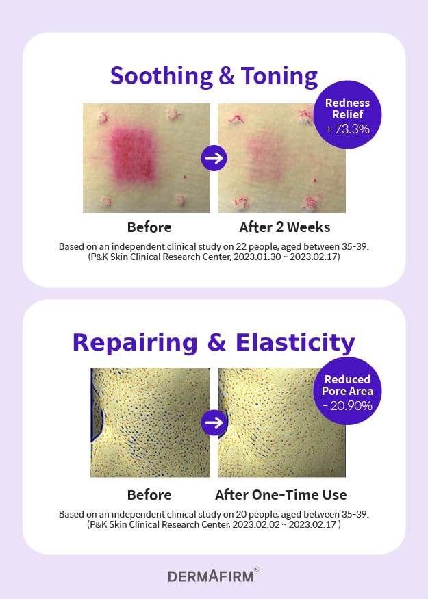 [Refill] DERMAFIRM Soothing Repair Toning Serum R4 - Korean Bakuchiol Retinol Niacinamide & Peptide Face Serum for Wrinkles - Calming, Moisturizing & Correcting- Paraben-Free, Cruelty-Free, 1.01 fl oz-GlimoraGlow