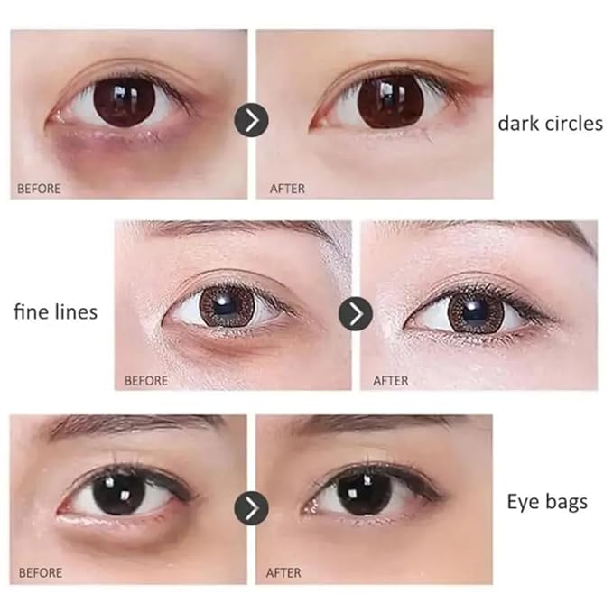 Time Eraser Rollerball, Retinol Anti-Wrinkle Eye Serum Oil, Eye Oil Roller, Reduces Fine Lines, Anti Wrinkle Serum For Eye-GlimoraGlow