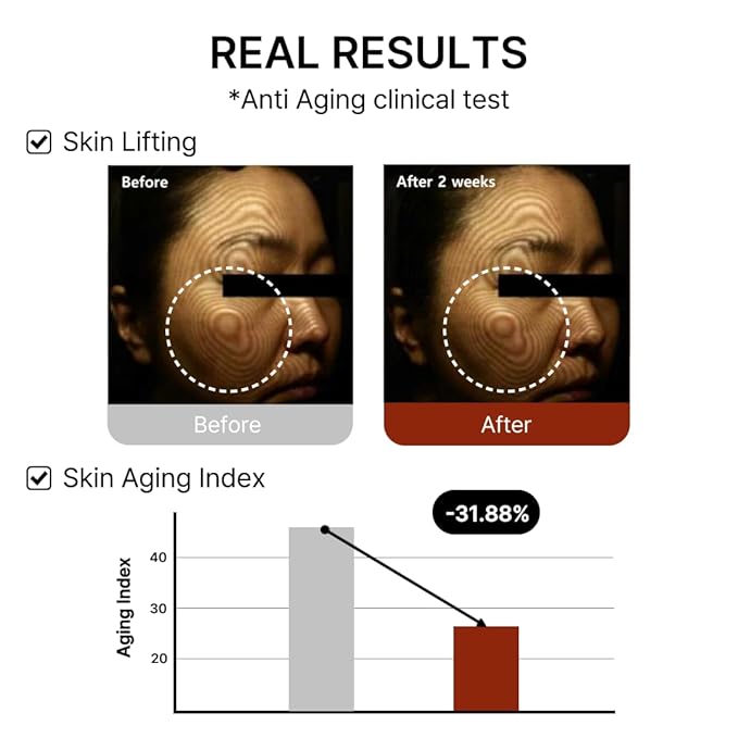 Mito-on Cell Rejuvenation Anti-Aging Serum, 30ml / 1.01 fl.oz –10% Niacinamide, Vitamin B3 and Antioxidants, Centella + EGF for Anti-Aging, Wrinkle Reduction, Pore minimization, Korean Skin Care-GlimoraGlow