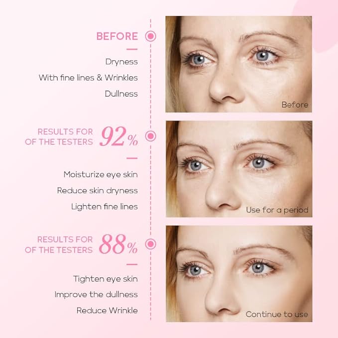 AKARY Cherry Blossom Eye Roller Serum Eye Moisturizer, Deep Hydration Eye Serum with Caffeine and Sodium Hyaluronate, Under Eye Cream to Reduce Dark Circles, Fine Lines, Smoothing Skin Care Treatment-GlimoraGlow