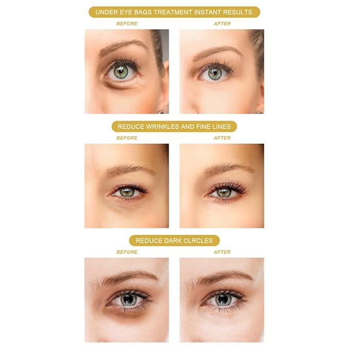 120PCS Under Eye Patches 24K Gold Eye Mask with Aloe Vera Natural Ingredients, Moisturizing Skin Care with Hyaluronic Acid and Collagen for Anti-Wrinkle, for Dark Circles and Puffiness-GlimoraGlow