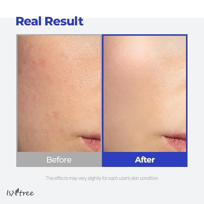 IsNtree Hyaluronic Acid Aqua Gel Cream 100ml, 3.38 fl oz | Korean Skincare | Lightweight Moisturizer | Quick-Absorbing Hydration | For Oily to Combination Skin-GlimoraGlow