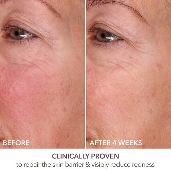 Dr Dennis Gross DermInfusions Fill + Repair Serum: Immediately Fills Lines, Plumps & Repairs, 1 oz-GlimoraGlow