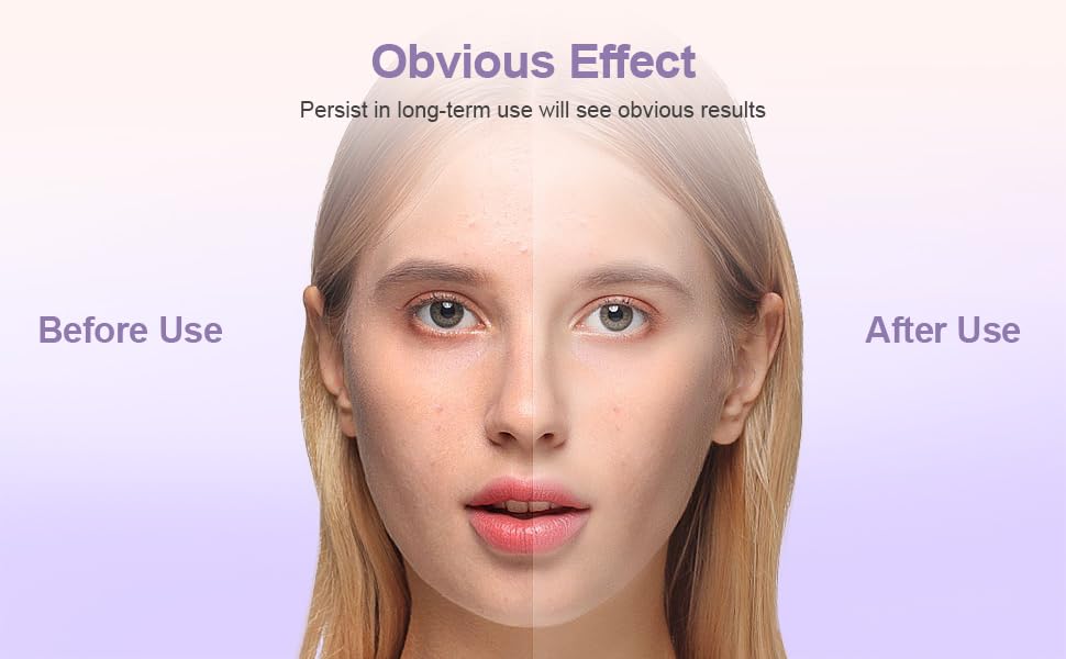 Facial Roller for Puffy Eyes, Ice Globes for Face 360° Rotating Eye Cream Applicator Tool Ice Roller for Face and Eyes-GlimoraGlow