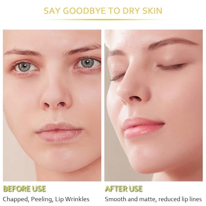 20Pcs Moisturizing Lip Mask, Restores Moisture Lip Care Mask for Dry Lips and Lip Lines Lips Overnight Lip Care, Gel Treatment Lip Masks Plumping Lips Mask (Yellow)-GlimoraGlow