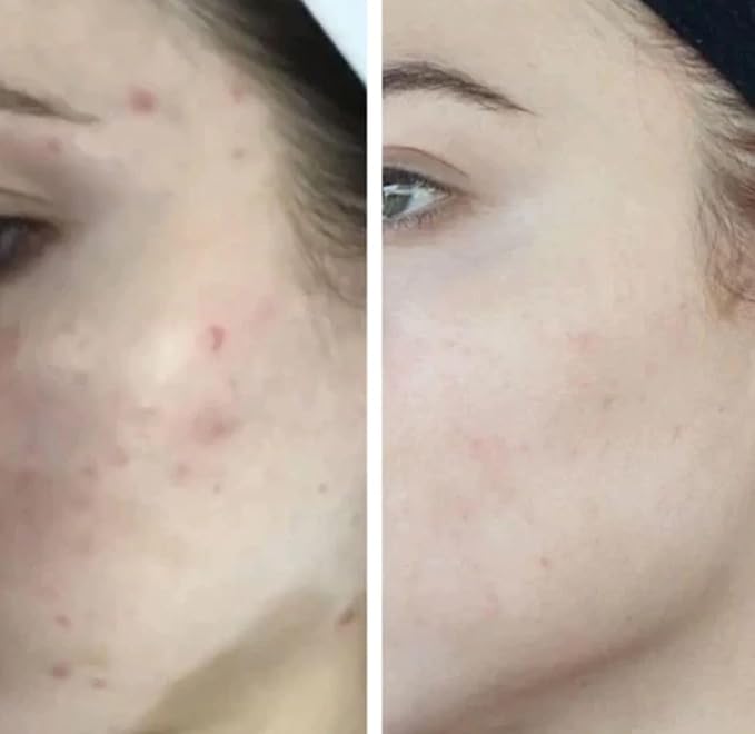 HigherDOSE Light-Activated GLOW SERUM - Anti Aging Face Serum to Plump, Hydrate & Smooth Fine Lines - Made with Vitamin C, Copper Peptides & Hyaluronic Acid - Boosts Benefits of Red Light (1 oz)-GlimoraGlow