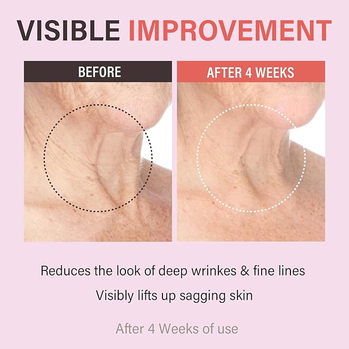 Retinol Collagen Lifting Neck Cream,Anti Aging Face and Neck Cream for Reduce Wrinkles and Hydrating & Lifting Neck,For Face, Neck, Décolleté Wrinkle Care, 1.76 oz.-GlimoraGlow