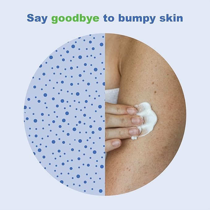 KP Elements Keratosis Pilaris Lotion (4 fl oz) - Natural Keratosis Pilaris Treatment, Moisturizing & Exfoliating AHA Lotion for KP, Vegan, Made in USA-GlimoraGlow