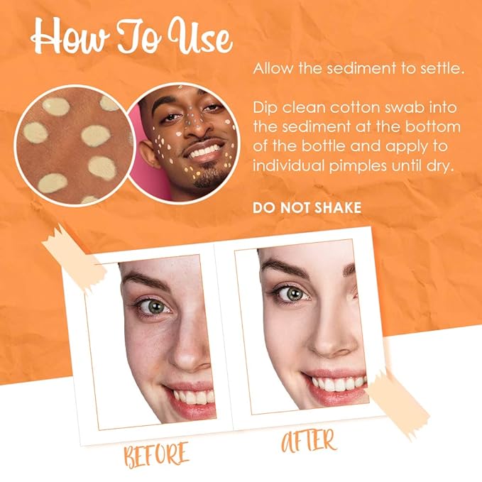 Bye Bye Blemish Dark Spot Lotion Vitamin C | Assists with Drying Blemishes And Brightening Skin | Fast Acting Solution | 1 Fl. Oz.-GlimoraGlow