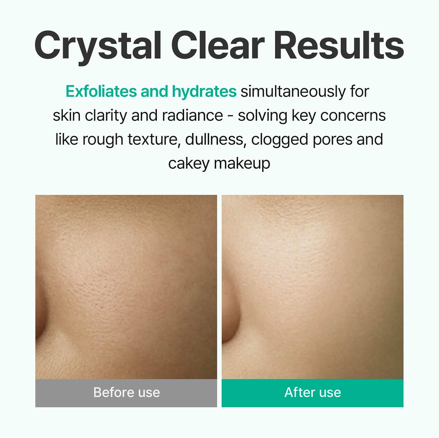 Centellian 24 AHA Aqua Peeling Boosting Ampoule (AHA Peeling Ampoule, 1.01fl oz) - Gentle Exfoliating & Hydrating Serum with AHA Complex, Refines Pores & Enhances Skin Clarity, Korean Skin Care-GlimoraGlow