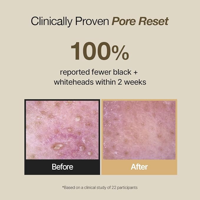 NDP Rice Mochi Deep Face Wash – Triple-Rice Airy Micro-Exfoliating Foam for Sensitive Skin, Phyto Mucin Hydration Shield, pH 5.5 Barrier-Safe Vegan Korean Skincare Cleanser, 4.05 fl oz (120 ml)-GlimoraGlow