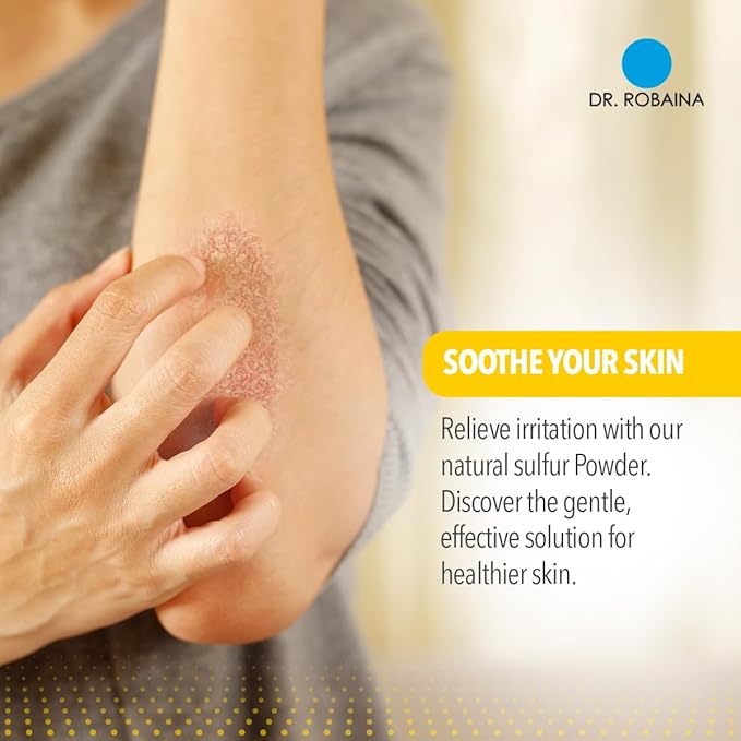 Dr. Robaina Sulfur Balsam Lotion – Lightweight Moisturizer for Dry, Flaky & Itchy Skin – Calms Redness, Supports Skin Barrier & Locks Hydration – Shea Butter & Tea Tree – 8 fl oz, USA Made-GlimoraGlow