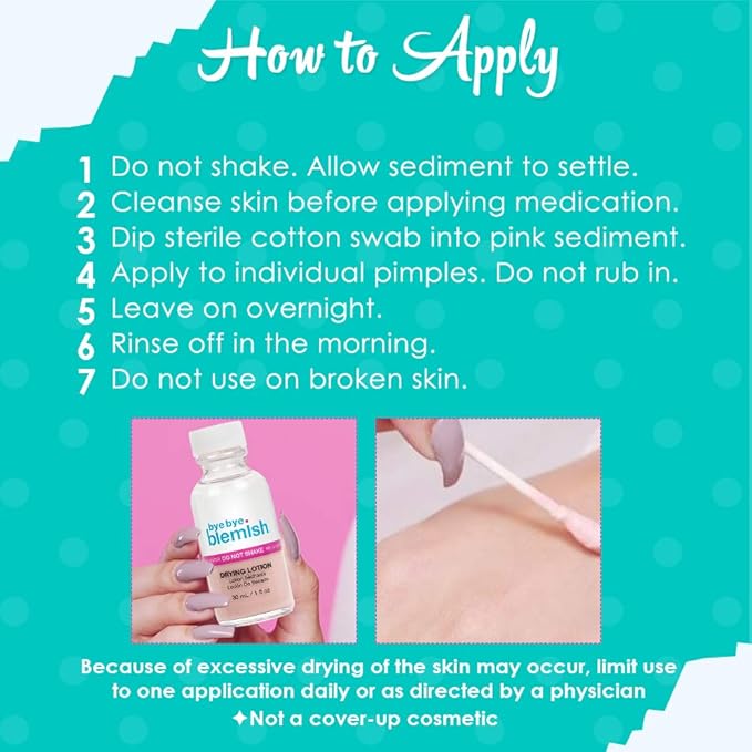 Bye Bye Blemish Acne Drying Lotion, Reduce Pimples Overnight 1oz, 1-Pack-GlimoraGlow