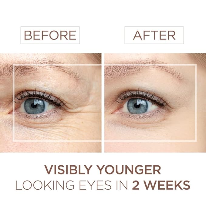 BEE and YOU Eye Cream, Anti Aging, Anti Wrinkle Serum 100% Natural with Bee Venom, Propolis Extract, Raw Honey, Hyaluronic Acid, For Dark Circles Under Eye Treatment and Puffiness, Skin Care, 15ml-GlimoraGlow