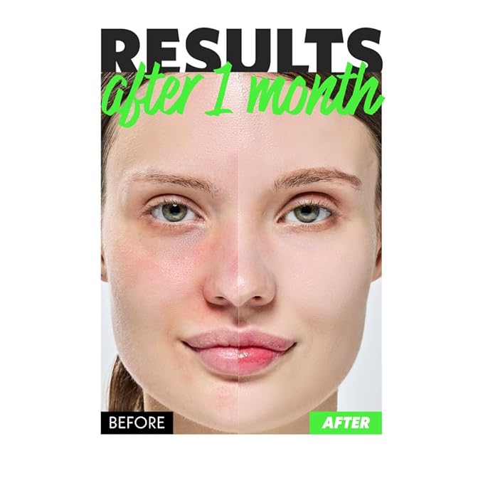 NOSCA9 Soothing Serum S - Rapid Hydrating Calming Serum with 5-Layer Ceramide Complex &Fresh Centella Asiatica, Advanced Barrier Repair for Sensitive Skin Korean Skin Care (2.02 Fl Oz (Pack of 2))-GlimoraGlow