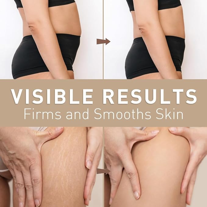 Belly Firming Cream: B Flat Skin Tightening Cream , Cellulite & Stretch Mark Reduction & Tummy Hips Cream & Body Firming for Stomach & Thighs & Arms – 3.38 Fl Oz-GlimoraGlow