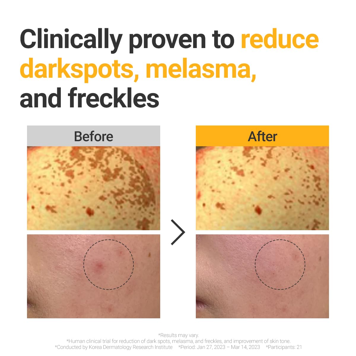 ROVECTIN Vita Dark Spot Serum for Clearing Blemish and Evening Skin Tone | Rich Vitamin C, Brightening, Hydrating For Dry, Sensitive, Normal, Oily Skin | Vegan K-Beauty (1.01 Fl. Oz, 30ml)-GlimoraGlow