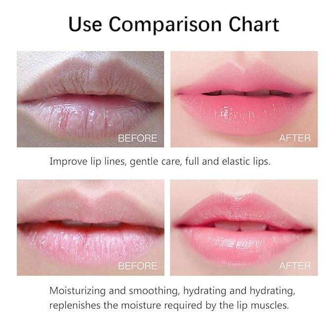 20Pcs Moisturizing/Plumping Lip Mask, Restores Moisture Mask for Dry Lips and Lines Overnight Care, Gel Treatment Masks (Pink)-GlimoraGlow